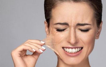 علاجات تقشير البشرة الناتج عن حروق الشمس