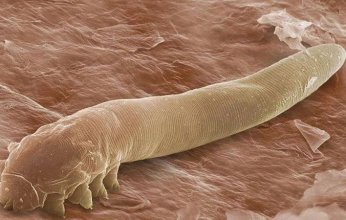 أرعب «السوشيال ميديا».. حقيقة مخلوق مجهري غامض يتغذى على الجلد