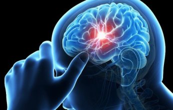 ثورة علاجية جديدة.. طبيب يجري عمليات إزلة أورام الدماغ بدون فتح الجمجمة