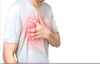 طبيب مصري: التشخيص الدقيق للذبحة الصدرية يتم من خلال تصوير الشريان التاجي