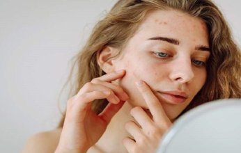 ماذا نعرف عن الطفح الوردي وطرق علاجه؟