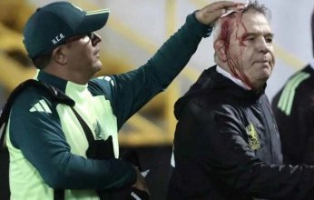 إصابة خطيرة لمدرب المكسيك عقب الخسارة في هندوراس