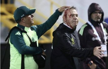 بعد إصابة أجيري.. «الكونكاكاف» يعاقب هندوراس