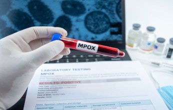 كندا تسجل أول حالة إصابة بجدري القردة في مقاطعة مانيتوبا