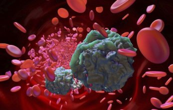 روسيا تبدأ الاختبارات السريرية لدواء مضاد لسرطان الدم