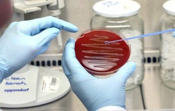 اكتشاف حلول جديدة لمكافحة البكتيريا المقاومة للمضادات الحيوية