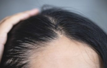 الجينسنغ.. الحل الطبيعي لتعزيز نمو الشعر ومنع تساقطه