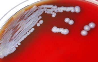 حائز على "نوبل" يحذر من بكتيريا تهدد الحياة على الأرض