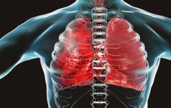 دراسة حديثة: الفيروس التاجي يؤثر على الكلى أكثر من الرئتين