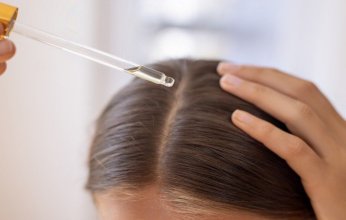 جل من السكر الطبيعي يساهم في محاربة الصلع الوراثي