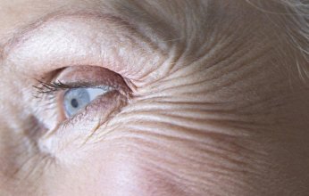 أخطاء شائعة تسرع ظهور التجاعيد العميقة ونصائح للوقاية منها