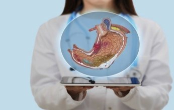 اكتشاف طبي مهم.. "فيتامين B5" قد يكون مفتاحاً لعلاج قرحة المعدة