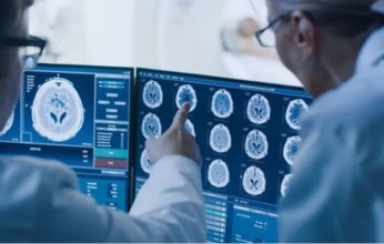 خاص| استاذ باطنة وحالات حرجة يُحذر مخاطر الإشعاع المنبعث من الأشعة المقطعية وعلاقته بالسرطان