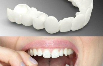 ثورة في طب الأسنان: تطوير أسنان حيوية باستخدام خلايا بشرية وخنزيرية