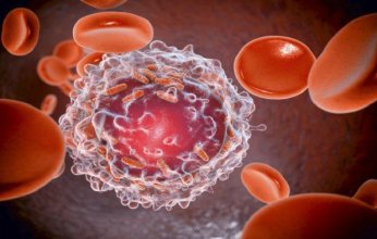 دراسة حديثة: الجمع بين الرياضة والحفاظ على الوزن يقلل خطر الإصابة بالسرطان