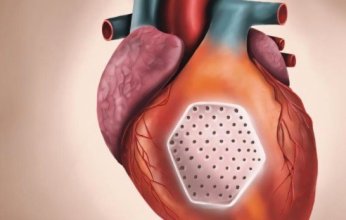 باحثون ألمان يطورون رقاقات قابلة للزرع لعلاج قصور القلب