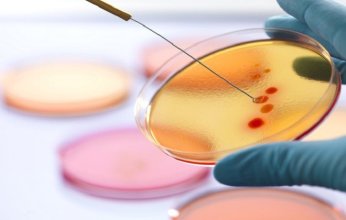 بعد 30 عاماً من البحث.. اكتشاف مضاد حيوي ثوري قد يغير مسار الطب