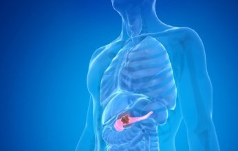 ما هي عوامل خطر الإصابة بسرطان البنكرياس؟