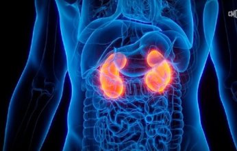 كيف تحافظ على صحة الكلى؟.. نصائح طبية هامة