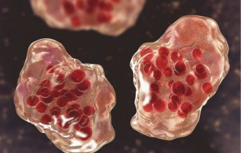 الحصبة تضرب واشنطن.. مخاوف من انتشار المرض وسط تراجع معدلات التطعيم