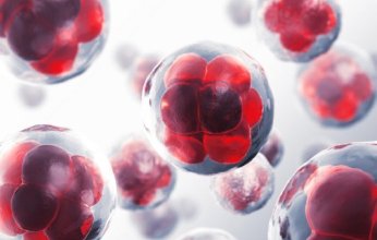 الورم النقوي المتعدد.. مرض خبيث يصيب الدم وهذه أبرز خصائصه