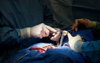 إنجاز طبي.. أطباء صينيون يزرعون كلية خنزير معدلة وراثيًا لإنقاذ حياة مريضة