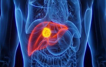 دراسة حديثة: أدوية شائعة قد توفر حماية وقائية من سرطان الكبد