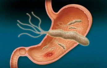 بالتفاصيل.. كل ما تريد معرفته عن أعراض «جرثومة المعدة» وطرق الوقاية