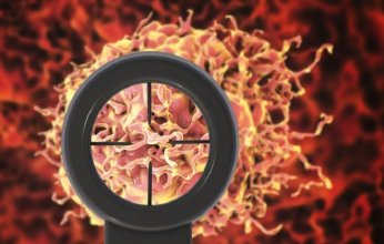 علماء أمريكيون يفكون لغز مقاومة سرطان البروستات لعقار شهير.. ما التفاصيل؟