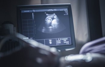 دراسة أمريكية حديثة: مواد كيميائية شائعة في المنازل قد تعيق نمو دماغ الجنين