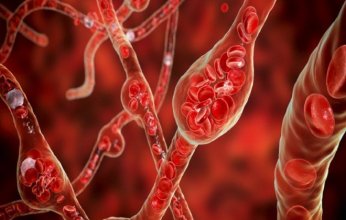 هل تخفّض تقنيات الاسترخاء ضغط الدم؟.. دراسة علمية تحسم الجدل