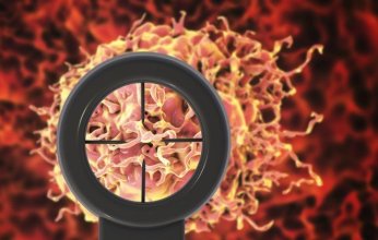 اختبار بول جديد يُحدث اختراقاً في تشخيص سرطان البروستات.. دقة أعلى وآفاق للكشف المبكر