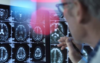 فيروس شائع قد يضاعف خطر الخرف المبكر لدى متوسطي العمر