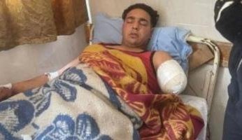 تطور جديد للقضية.. طلب «50 ناقة» تعويضًا لضحية «نمر طنطا».. والمصاب في حالة نفسية حرجة