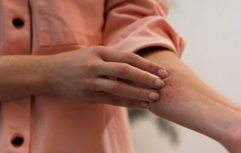 دواء شائع ضد الطفيليات يُظهر فعالية واعدة في علاج سرطان جلدي نادر