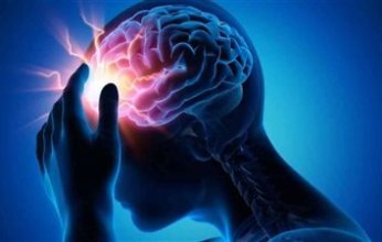 الذكاء الاصطناعي يساعد في اكتشاف جينات مرتبطة بالسكتة الدماغية