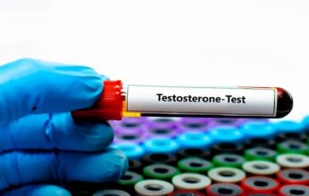 هرمون التستوستيرون لدى النساء.. لاعب خفي في توازن الصحة والخصوبة