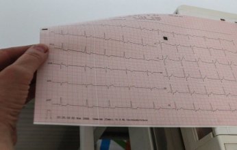 باحثون روس يبتكرون نموذجًا حاسوبيًا لمحاكاة القلب وعلاج الرجفان الأذيني