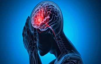 دراسة حديثة تكشف العلاقة بين صحة الفم والصداع النصفي