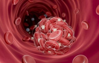 دراسة حديثة تكشف عن "خطر صامت" يهدد القلب والشرايين بسبب الجسيمات البلاستيكية