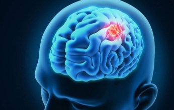 اكتشاف طريقة جديدة لتحسين علاج أورام الدماغ العدوانية