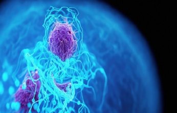 5 ممارسات شائعة قد ترفع خطر الإصابة بالسرطان: تحذيرات من خبير أورام أمريكي