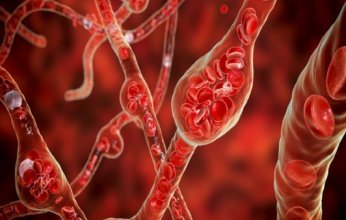 دراسة واعدة: الشوكولاتة والتفاح قد يسهمان في خفض ضغط الدم