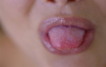 اللسان مرآة لصحة الجهاز الهضمي وتغير لونه مؤشر يجب عدم تجاهله