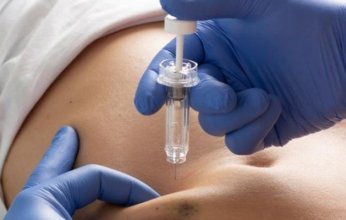 تحجب الخلايا المصابة وتختصر الوقت.. حقنة جديدة لعلاج السرطان