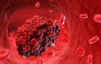 تقنية يابانية جديدة لرصد تخثر الدم في الوقت الفعلي دون جراحة