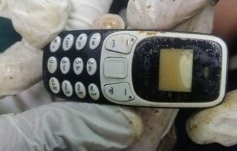 صدق أو لا تصدق.. استخراج هاتف محمول من معدة مريض بعد عامين