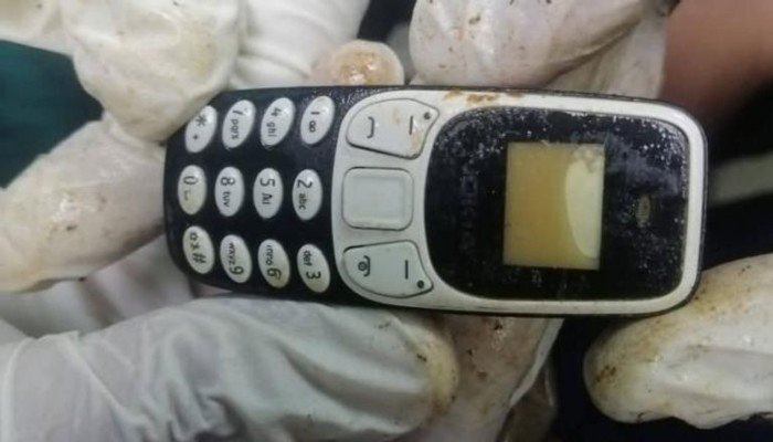 صدق أو لا تصدق.. استخراج هاتف محمول من معدة مريض بعد عامين صدق أو لا تصدق.. استخراج هاتف محمول من معدة مريض بعد عامين