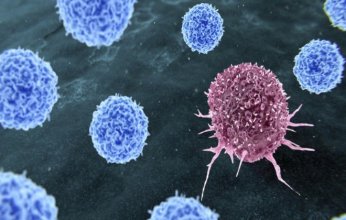 ثورة طبية واعدة.. علاج ضوئي جديد للسرطان قد يُنهي عصر الكيميائي والإشعاعي