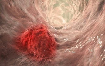 «أسبرين الأطفال».. حبة صغيرة قد تقيك من خطر كبير